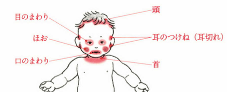 f:id:Dr-KID:20170724093342p:plain f:id:Dr-KID:20170724093342p:plain