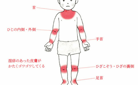 f:id:Dr-KID:20170724093823p:plain f:id:Dr-KID:20170724093823p:plain