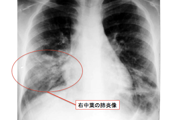 f:id:Dr-KID:20170727130002p:plain f:id:Dr-KID:20170727130002p:plain