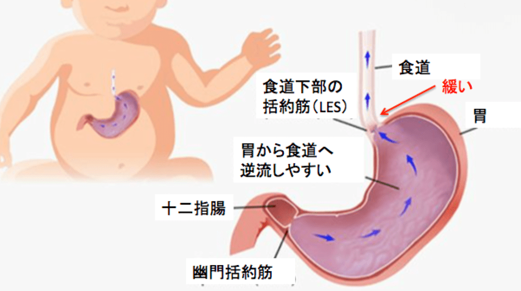 f:id:Dr-KID:20170810135903p:plain f:id:Dr-KID:20170810135903p:plain