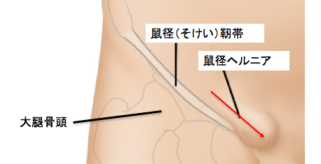 f:id:Dr-KID:20180428082139p:plain f:id:Dr-KID:20180428082139p:plain