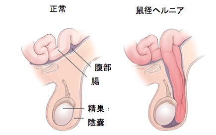 f:id:Dr-KID:20180428083017p:plain f:id:Dr-KID:20180428083017p:plain