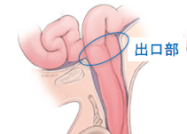 f:id:Dr-KID:20180428083827p:plain f:id:Dr-KID:20180428083827p:plain