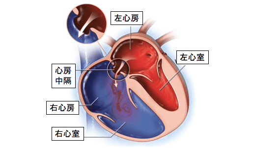 f:id:Dr-KID:20180509041529p:plain f:id:Dr-KID:20180509041529p:plain