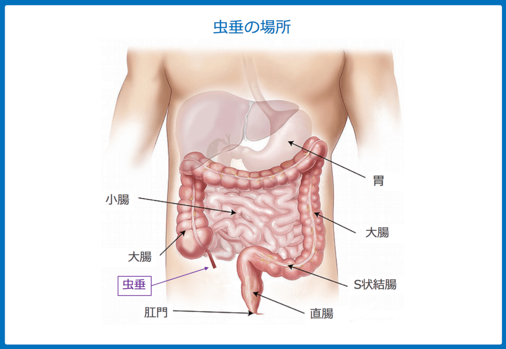 f:id:Dr-KID:20180515070103p:plain