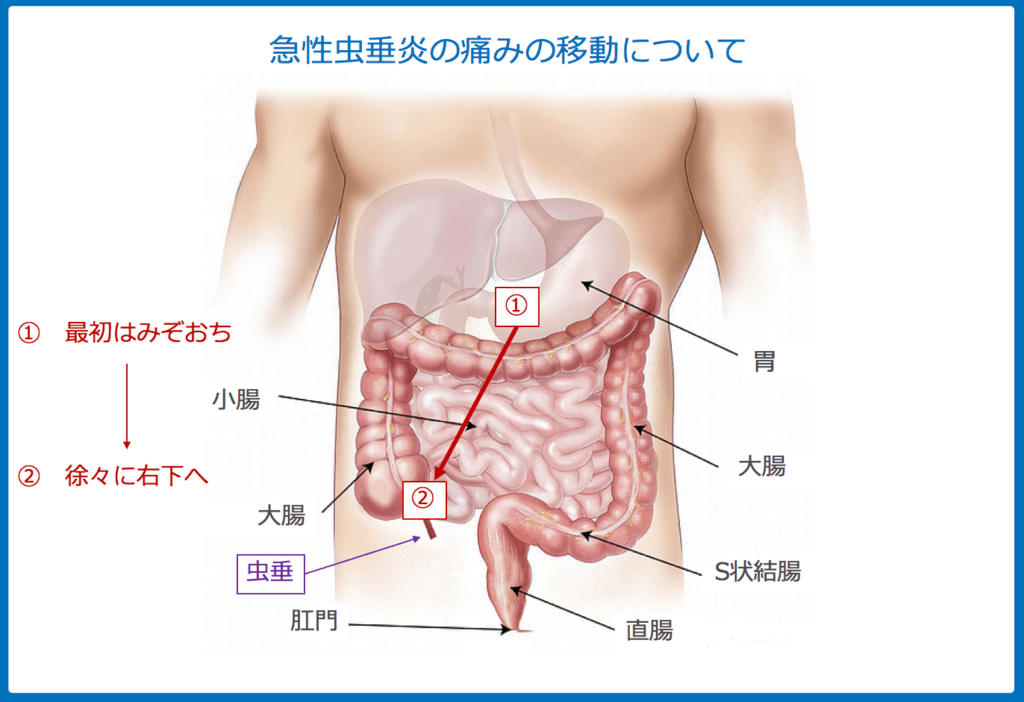 f:id:Dr-KID:20180515070121p:plain