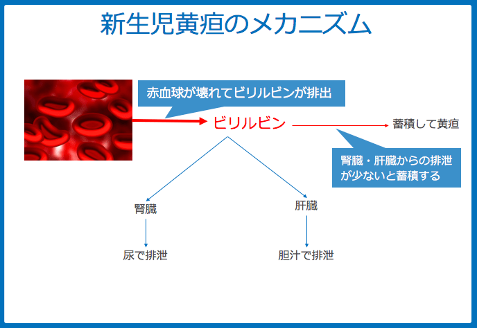 f:id:Dr-KID:20180524030654p:plain