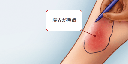 f:id:Dr-KID:20180526062158p:plain f:id:Dr-KID:20180526062158p:plain