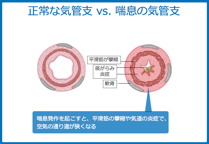 f:id:Dr-KID:20180529030743p:plain f:id:Dr-KID:20180529030743p:plain
