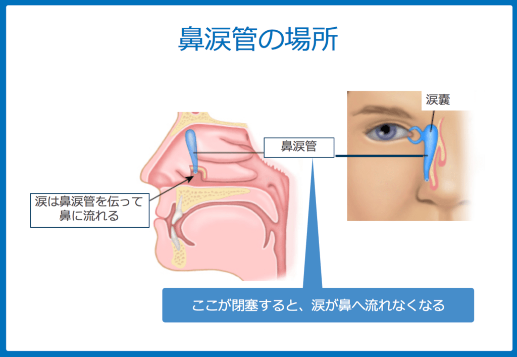 f:id:Dr-KID:20180608043337p:plain f:id:Dr-KID:20180608043337p:plain