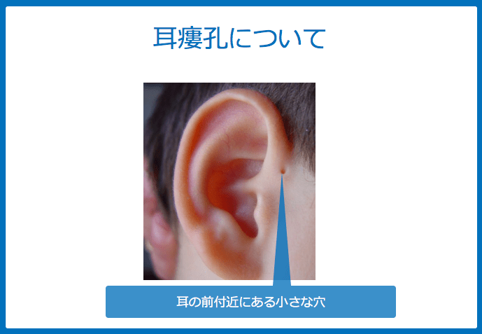 f:id:Dr-KID:20180610033253p:plain f:id:Dr-KID:20180610033253p:plain