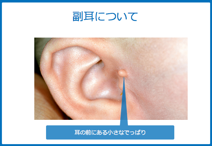 f:id:Dr-KID:20180610040614p:plain f:id:Dr-KID:20180610040614p:plain