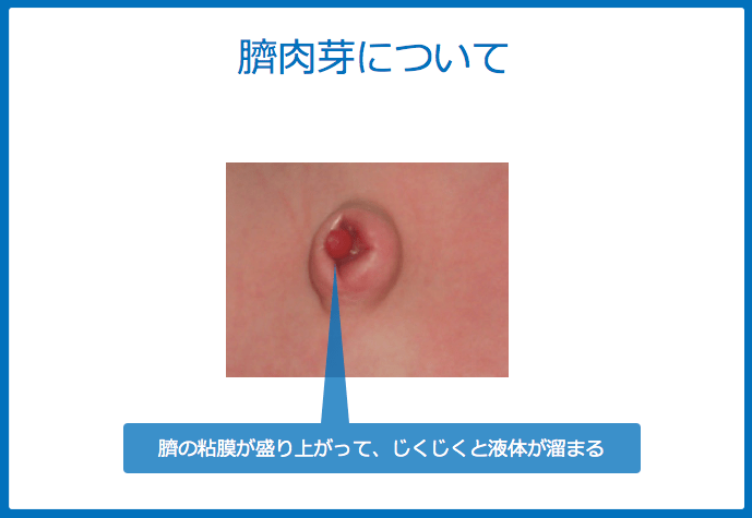 f:id:Dr-KID:20180610192053p:plain f:id:Dr-KID:20180610192053p:plain