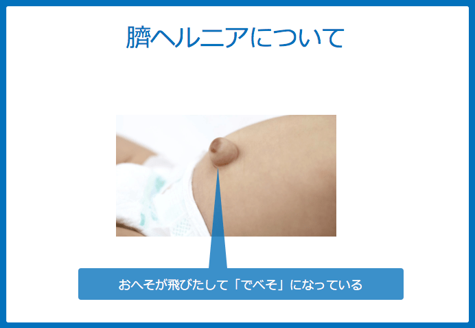 f:id:Dr-KID:20180610193046p:plain f:id:Dr-KID:20180610193046p:plain