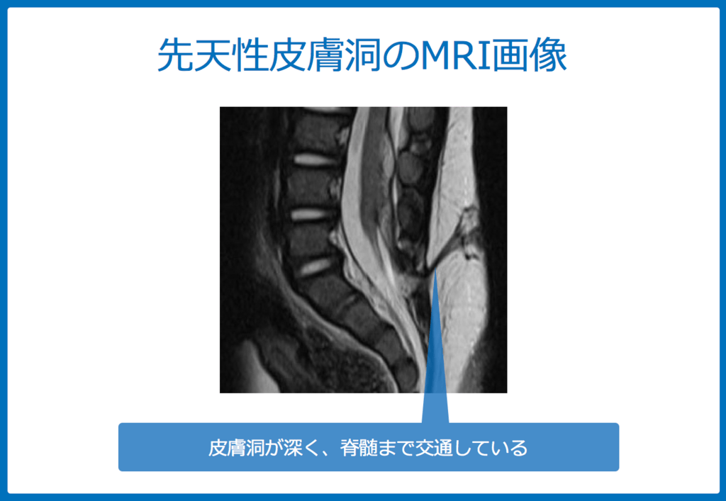f:id:Dr-KID:20180611023140p:plain f:id:Dr-KID:20180611023140p:plain