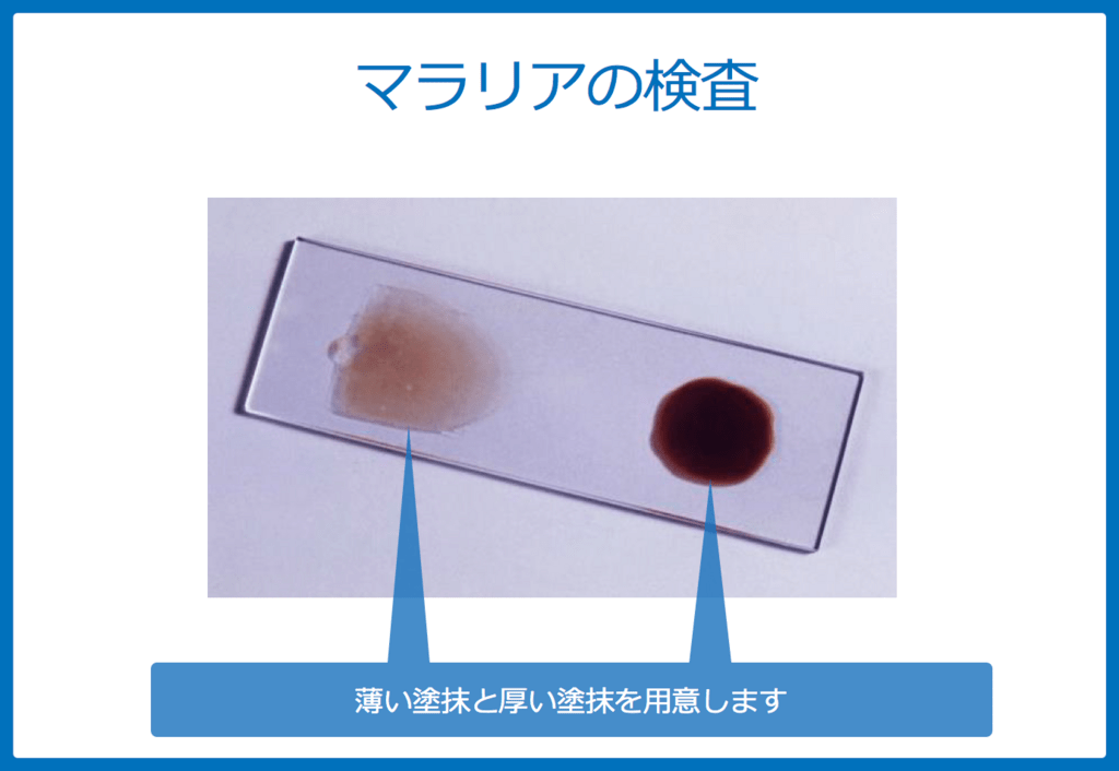 f:id:Dr-KID:20180618051531p:plain f:id:Dr-KID:20180618051531p:plain