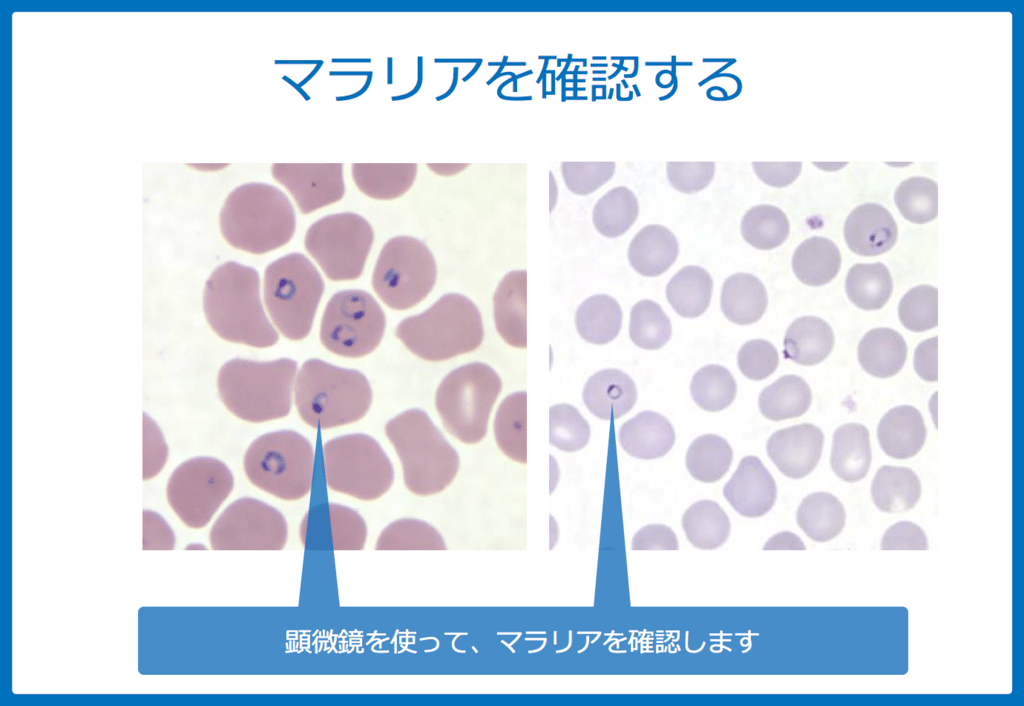f:id:Dr-KID:20180618051910p:plain f:id:Dr-KID:20180618051910p:plain