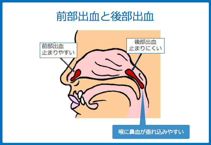 f:id:Dr-KID:20180620001324p:plain f:id:Dr-KID:20180620001324p:plain