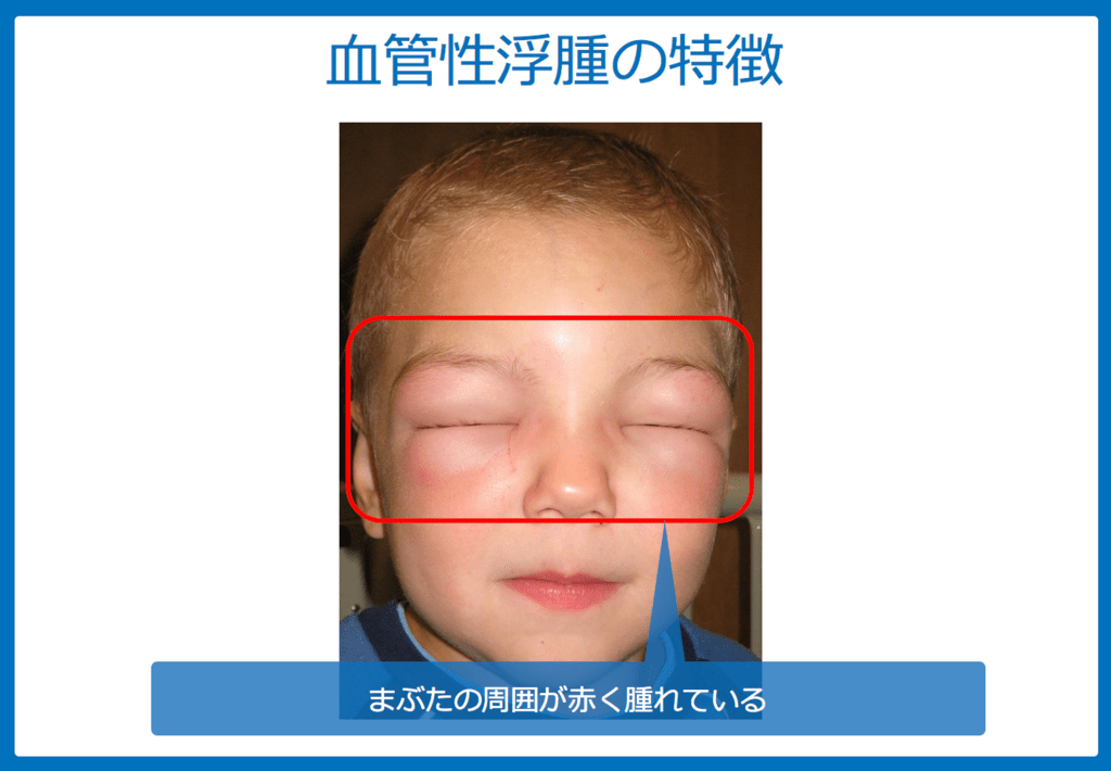 f:id:Dr-KID:20180623161610p:plain f:id:Dr-KID:20180623161610p:plain
