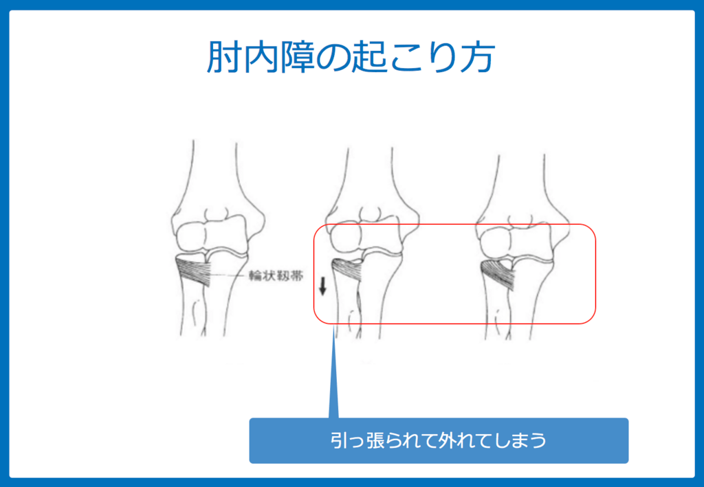 f:id:Dr-KID:20180701184942p:plain f:id:Dr-KID:20180701184942p:plain