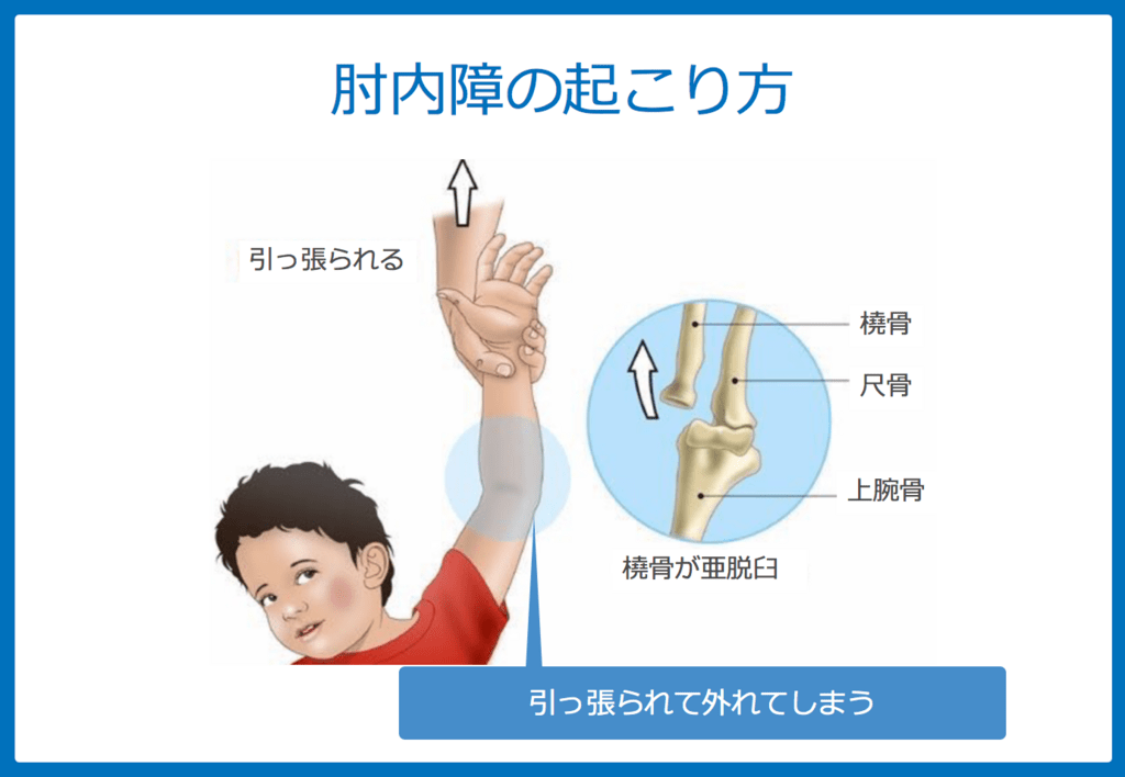 f:id:Dr-KID:20180701185247p:plain f:id:Dr-KID:20180701185247p:plain